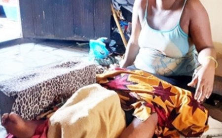Mysterious Leg Fracture Leaves Abuja Widow Helpless, Seeks Urgent Support